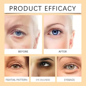 Gentian Anti Wrinkle Eye Cream can fade eye lines, repair dark circles, eye bags, and puffiness (3PC)